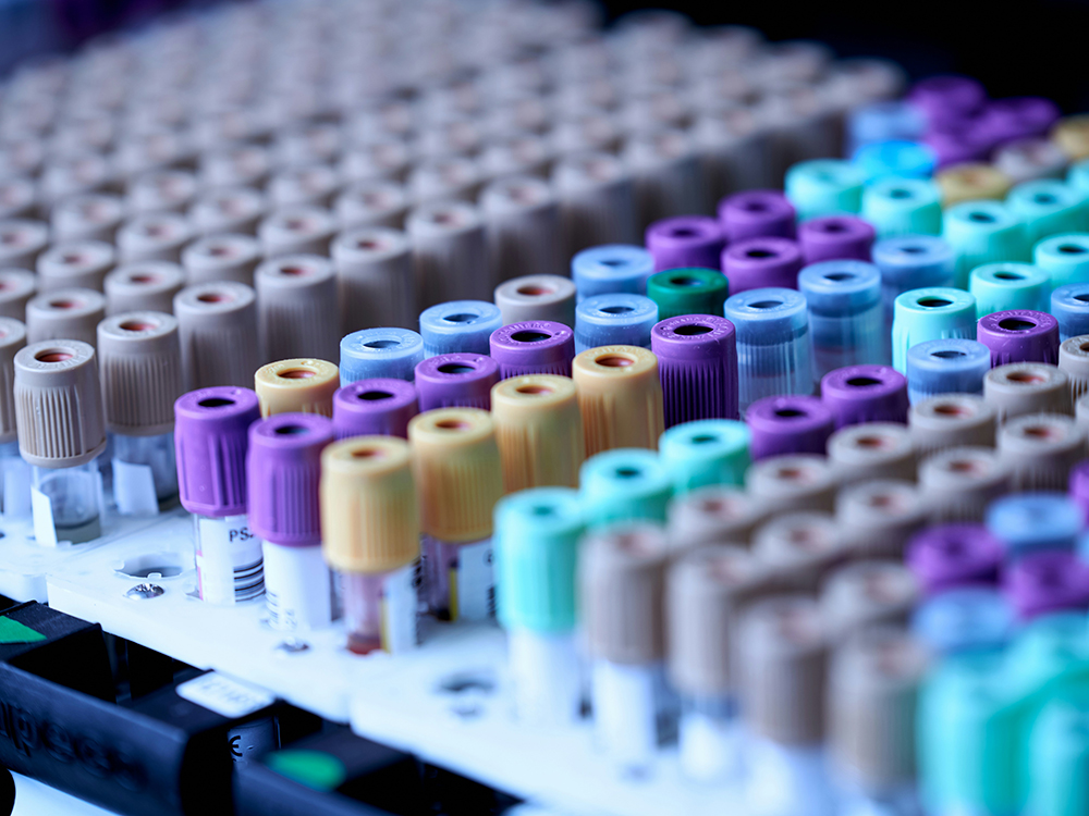 Rows of colorful laboratory test tubes with caps organized in a rack, used for sample analysis.